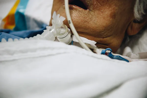 Paciente hace traqueostomía y ventilador en el hospital — Foto de Stock