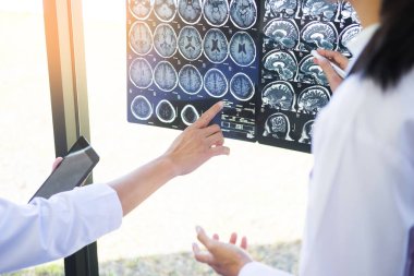 İki doktor tarama veya x-ışını analiz film veya Ct ani kalp durması açıklar