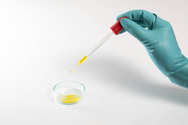  Petri 'de sarı sıvı testi yapılan laboratuvar laboratuvar damlatıcısı. 