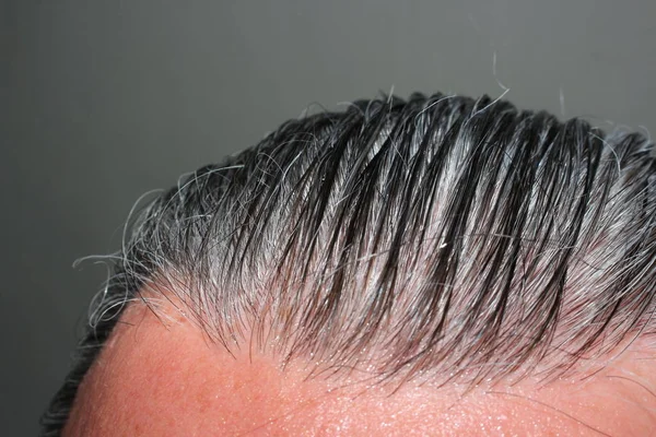 Сырые седые волосы — стоковое фото