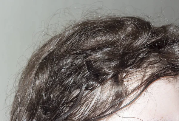 Genç Bir Kızın Dağınık Saçları Topuz Şeklinde Toplanmış — Stok fotoğraf