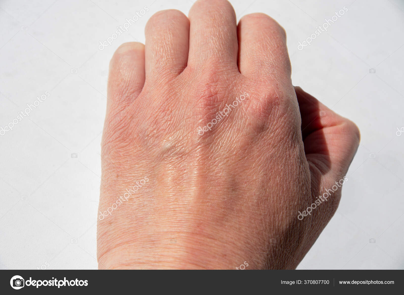 12pcs Gel Finger Cots Silicone Finger Protectors, Breathable