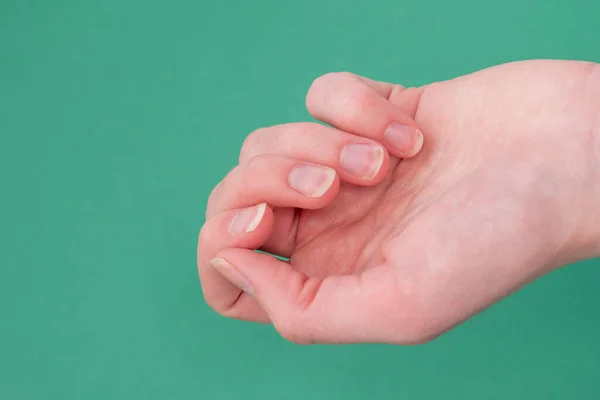 Zbliżenie łamliwych paznokci, białej kobiecej dłoni na zielonym tle. Pomysł manicure — Zdjęcie stockowe