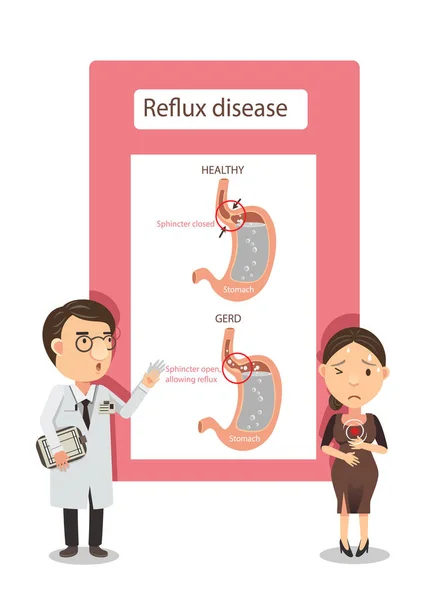 Syra Reflux Vektor Illustration — Stock vektor