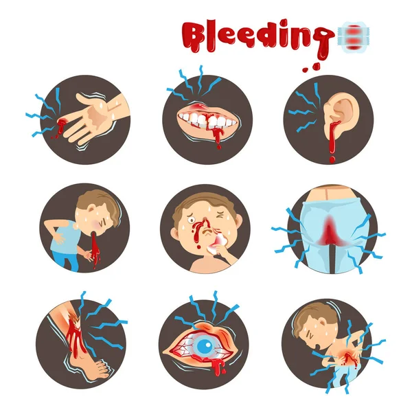 Sangramento Ilustração Vetor Médico — Vetor de Stock