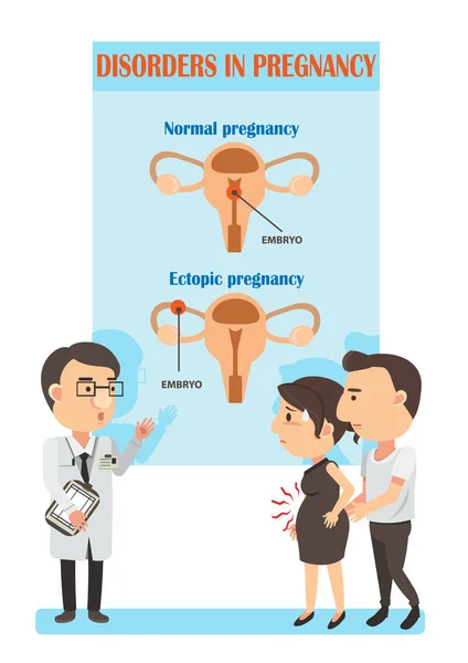 Méhen Kívüli Terhesség Vektor Illusztráció — Stock Vector