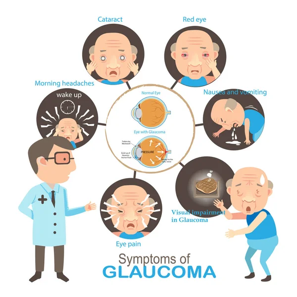 Illustrazione Del Vettore Della Malattia Del Glaucoma — Vettoriale Stock