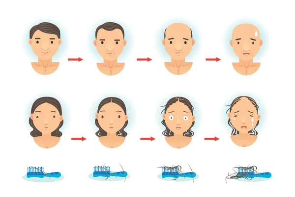 Векторная Иллюстрация Потери Волос — стоковый вектор