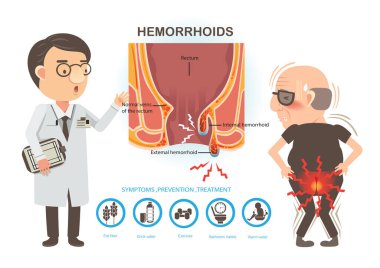 Hemoroitler vektör illüstrasyonunu ayarlar