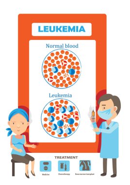 Lösemi vektör çizimi