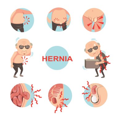 Hernia set vector illustration clipart