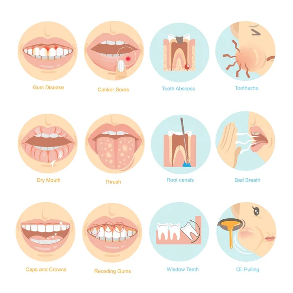 Oral Problems Vector Illustration — Stock Vector