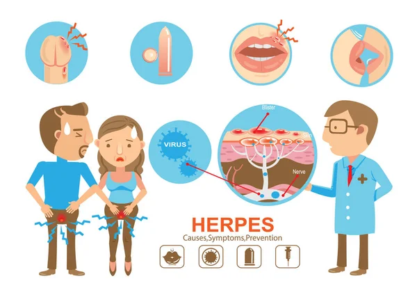 Herpes Conjunto Ilustração Vetorial — Vetor de Stock