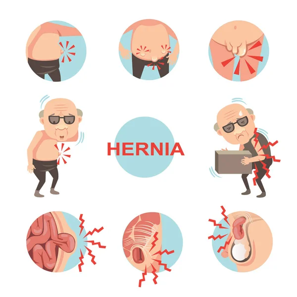 Hernia Conjunto Vetor Ilustração —  Vetores de Stock