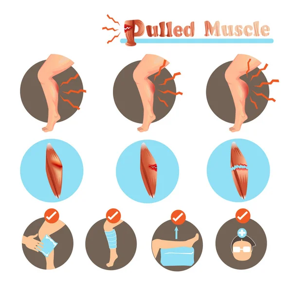 Illustrazione Del Vettore Lesioni Muscolari — Vettoriale Stock