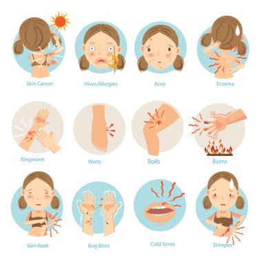 Skin Problems vector illustration clipart