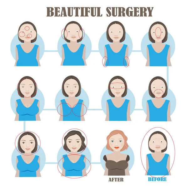 Unattractive Surgery Vector Illustration — Stock Vector