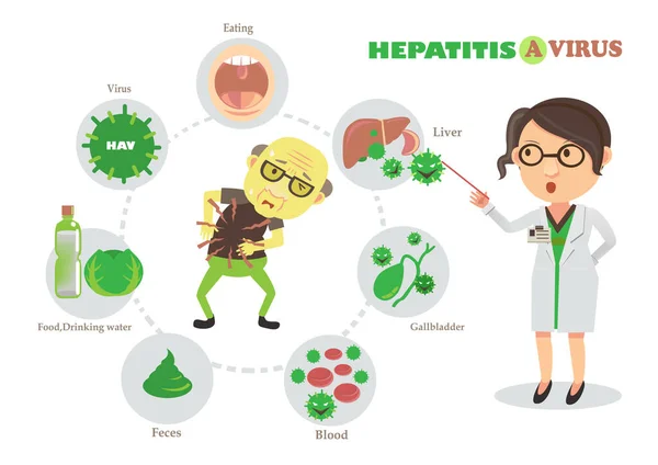 Hepatitis Virus Vector Ilustración — Vector de stock