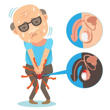 Testicular Pain vector illustration clipart