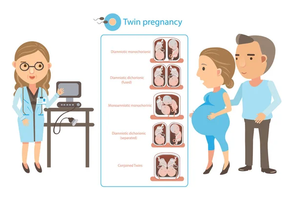 双子の妊娠ベクトル図 — ストックベクタ