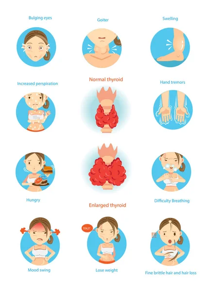超甲状腺功能集矢量图解 — 图库矢量图片