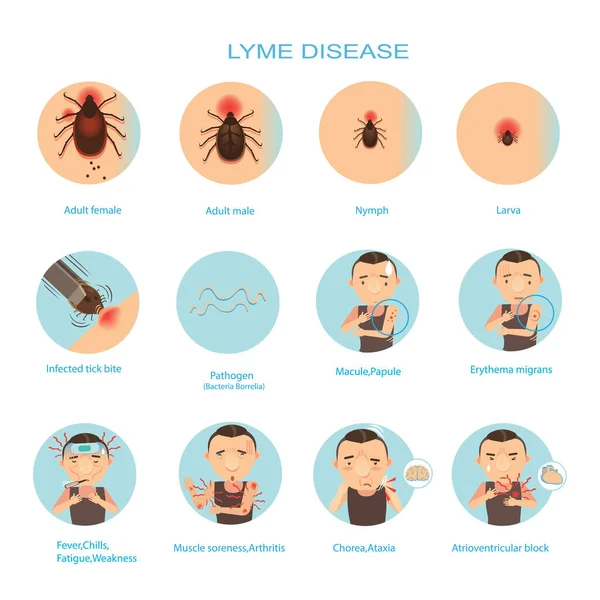 Εικονογράφηση Φορέα Νόσου Lyme — Διανυσματικό Αρχείο