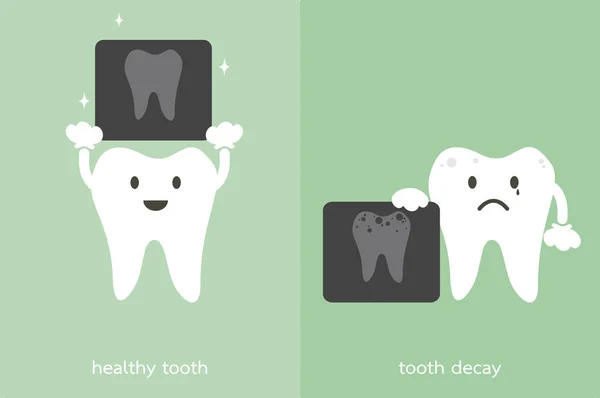 Carie sana dei denti e dei denti con pellicola a raggi X dentale — Vettoriale Stock