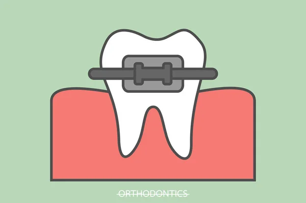 Ortodoncii zuby nebo zubní rovnátka — Stockový vektor