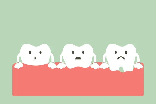 Step of gum disease — Stock Vector