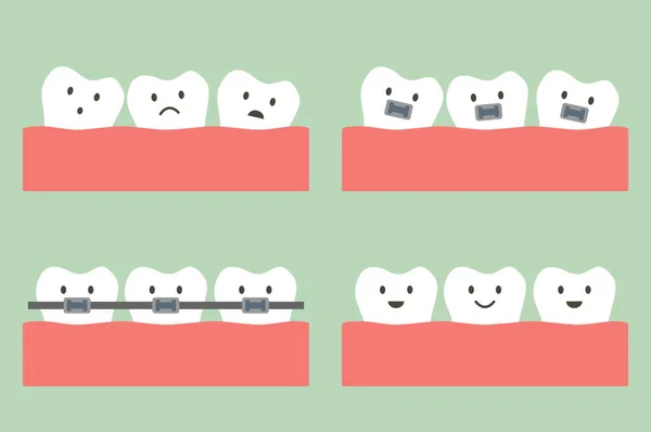 Tratamiento de ortodoncia dental con ortodoncia dental — Archivo Imágenes Vectoriales