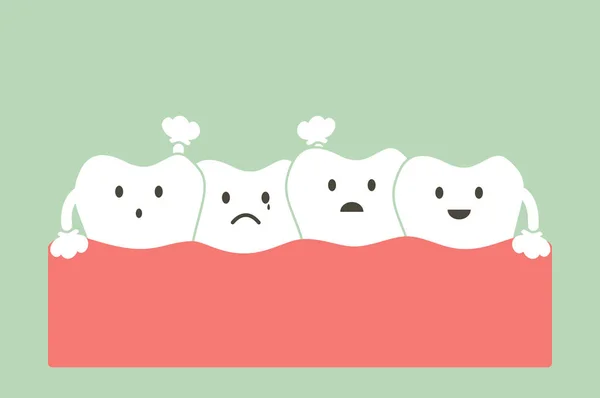Verdringing tanden (malocclusie ) — Stockvector