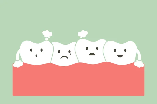 Apiñamiento de dientes (maloclusión  ) — Archivo Imágenes Vectoriales