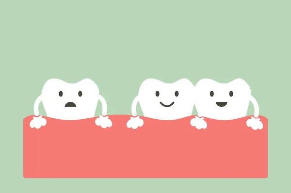 Espaciamiento de los dientes (diastema  ) — Archivo Imágenes Vectoriales