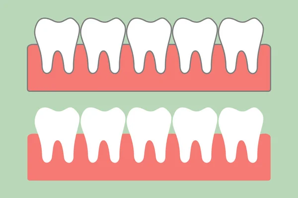 Gesunde Zähne auf Zahnfleisch für die Zahnpflege — Stockvektor