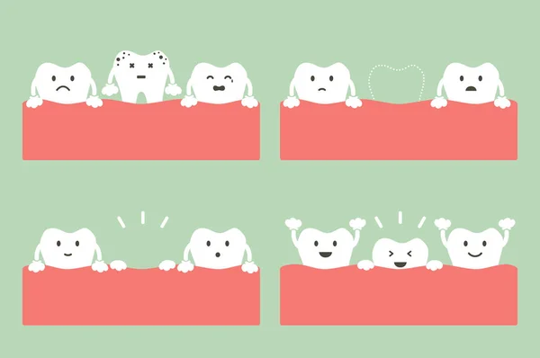 Passo de cárie a primeiros dentes —  Vetores de Stock