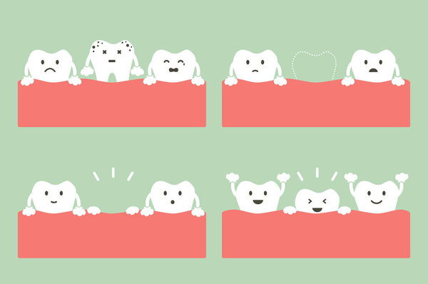 step of caries to first teeth