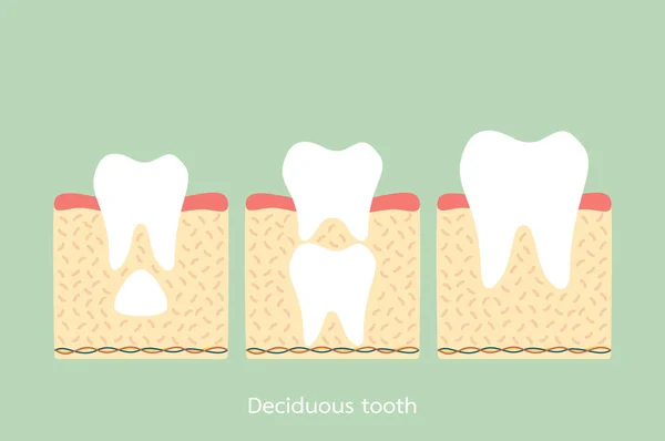 Dente permanente situato sotto il dente primario, struttura anatomica compreso l'osso e gomma — Vettoriale Stock