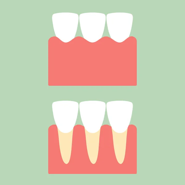 Egészséges metszőfog fogak gumi a fogászati ellátás — Stock Vector