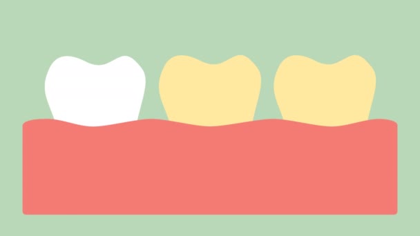 Blanqueamiento Dientes Por Chapas Diente Amarillo Blanco Vector Dibujos Animados — Vídeos de Stock