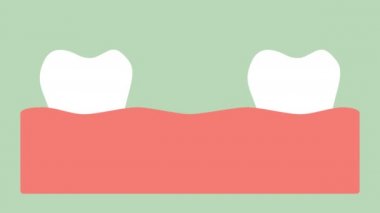 aralığı diş (diastema), diş ağız - diş çizgi film vektör düz stil arasında boşluk render 2d görüntüleri animasyon, 4k ve Uhd ultra yüksek çözünürlüklü video formatı 3840 x 2160