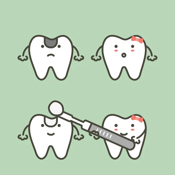 Paso del diente de caries al relleno de los dientes, antes y después — Vector de stock