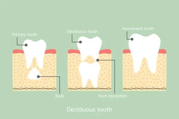 Permanent tooth located below primary tooth, anatomy structure including the bone and gum with detail word — Stock Vector