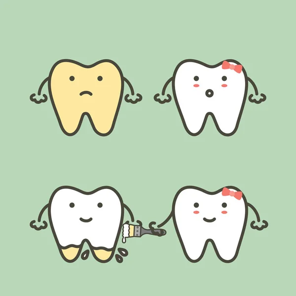 Paso de blanqueamiento de dientes - diente amarillo a diente blanco, antes y después — Vector de stock