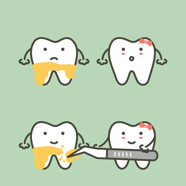 Étape de mise à l'échelle des dents - retrait de la plaque dentaire, avant et après — Image vectorielle