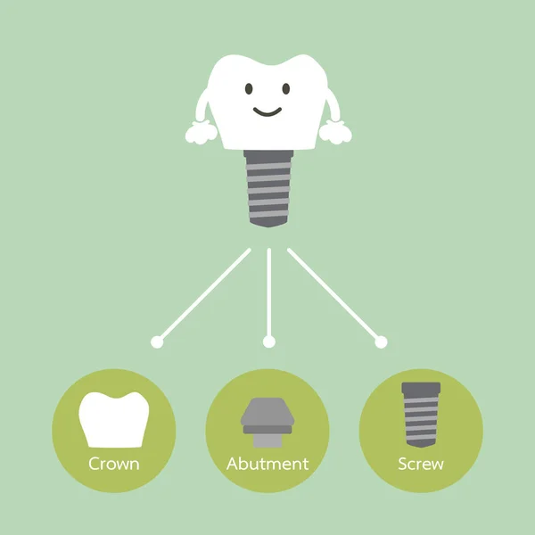 Estructura del implante dental con todas las partes desmontadas, corona, estribo, tornillo — Archivo Imágenes Vectoriales