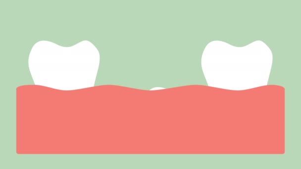 Trängsel Tänder Bettavvikelser Dental Tecknade Vektor Platt Stil Återge Footage — Stockvideo
