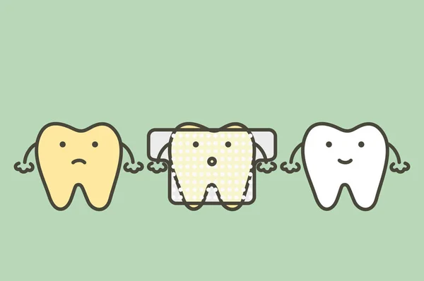 Gele tand gebruikt tanden whitening strip — Stockvector