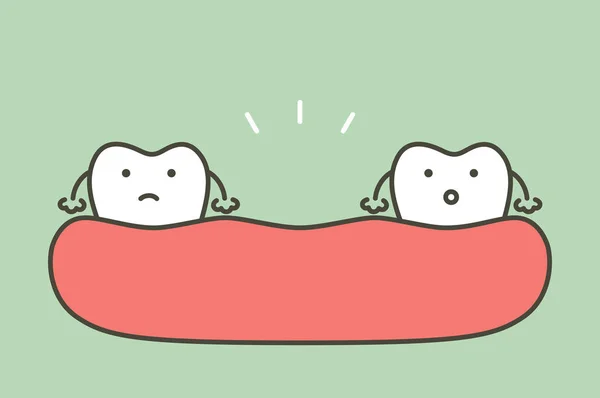 Dente mancante, spazio tra i denti in bocca — Vettoriale Stock