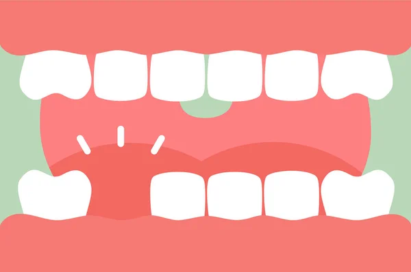 Erős fogak, a nyelv és a hiányzó fogat nyitott szájjal — Stock Vector