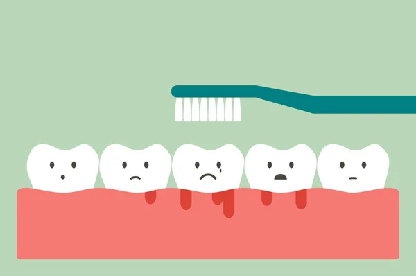 Fogmosás fogak, íny és fog, fogínygyulladás vagy aljas koncepció vérzés — Stock Vector